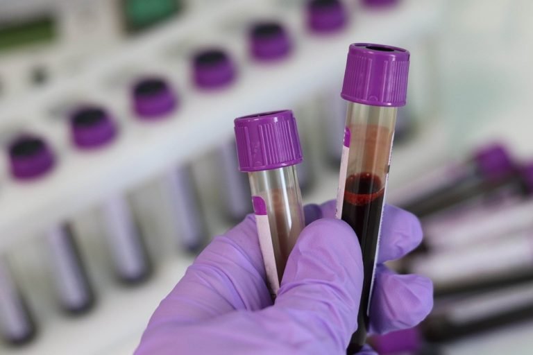 laboratory-g8fd1171a0_1280