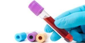 La química sanguínea ayuda a los profesionales de la salud a conocer el estado general de ciertos órganos y sistemas.