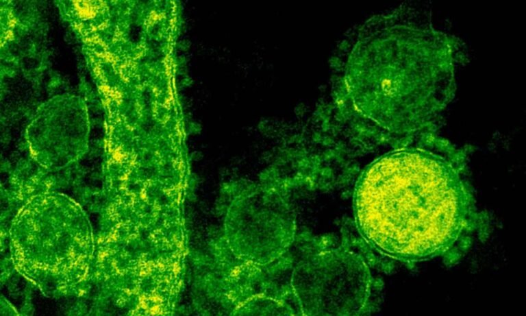 superbacterias Foto de CDC en Pexels